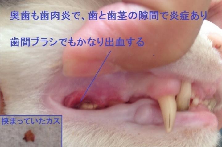 赤ちゃん 歯茎 血 血友病患者と小児歯科 18年3月号 血友病患者さんとご家族のための情報誌 Echo ヘモフィリア ヴィレッジ